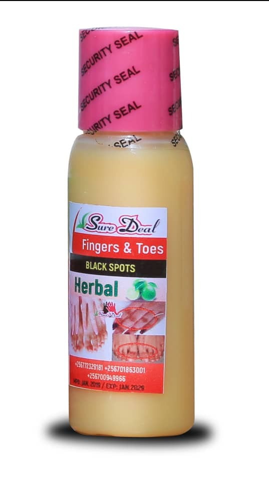 Sure Deal Finger & Toes Back Spots Herbal